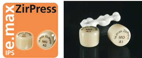 e.max: Bond or Cement? Gary DeWood e.max Bond or Cement fig 3