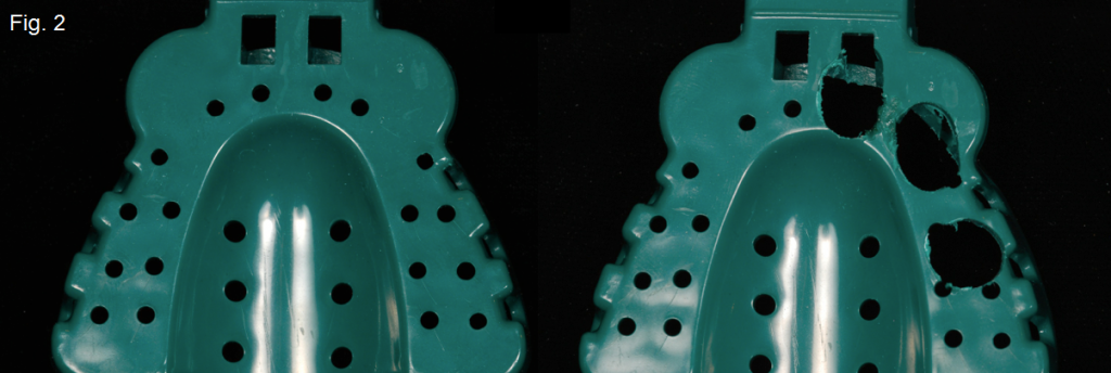 'Closed Tray' vs. ‘Open Tray' Implant Impressions Gregg Kinzer Closed Tray vs Open Tray Figure 2