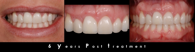 Does Facial Growth Continue as We Age? Greggory Kinzer Does Facial Growth Continue as We Age Figure 3