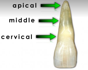 Horizontal Root Fracture: Extract or Retain? Greggory Kinzer Horizontal Root Fracture Extract or Retain Fig2