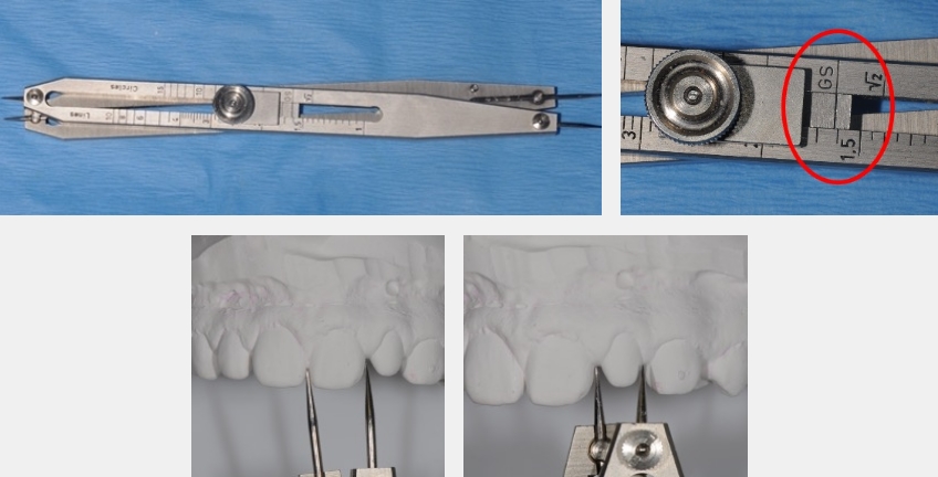 Using Golden Percentage in Dentistry for Ideal Tooth Proportions JeffreyBonk GoldenPercentDentIdealTooth Fig.6