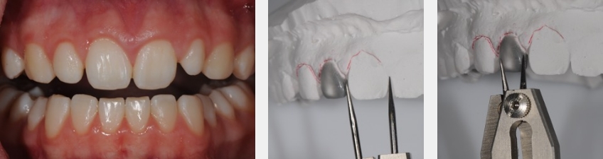 Using Golden Percentage in Dentistry for Ideal Tooth Proportions JeffreyBonk GoldenPercentDentIdealTooth Fig.7