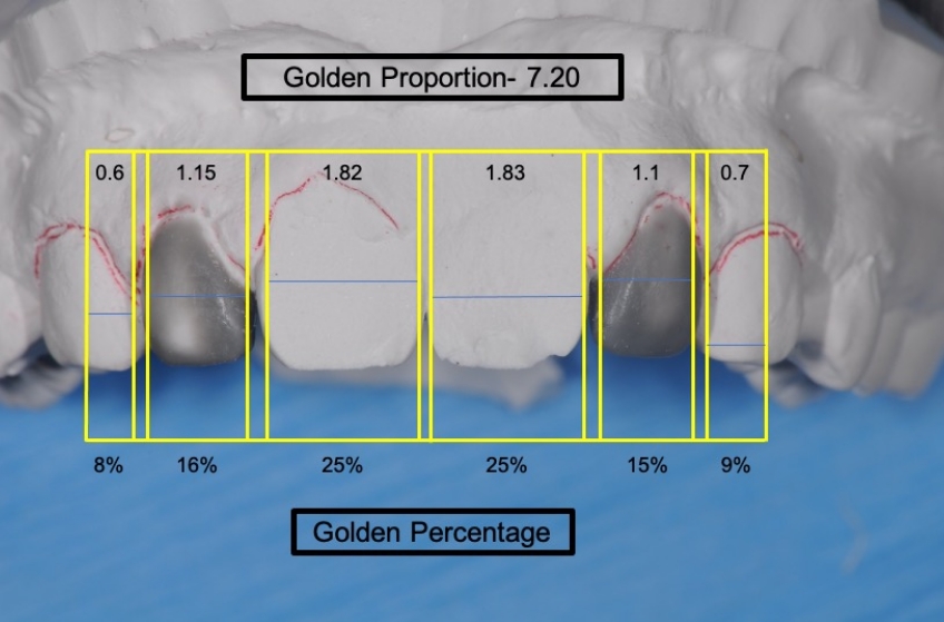 Using Golden Percentage in Dentistry for Ideal Tooth Proportions JeffreyBonk GoldenPercentDentIdealTooth Fig.8