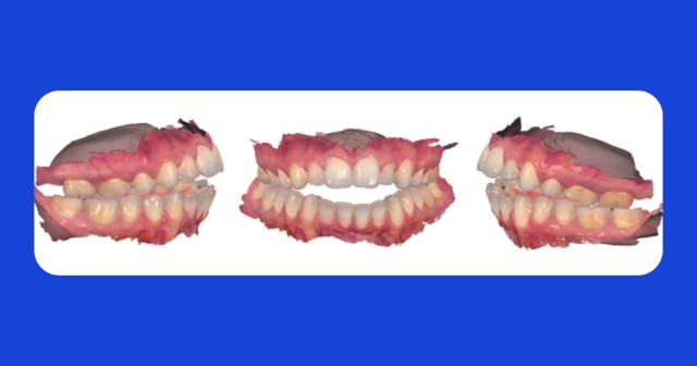 Spear Digest Jim McKee Condylar Resorption Featured image