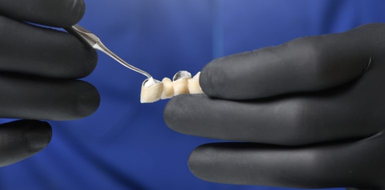 The Pros and Cons of Dental Cements