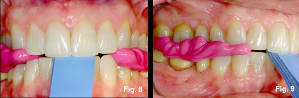 Using a Leaf Gauge With Intention: Part II Kevin Kwiecien Using a Leaf Gauge with Intention Figure 9