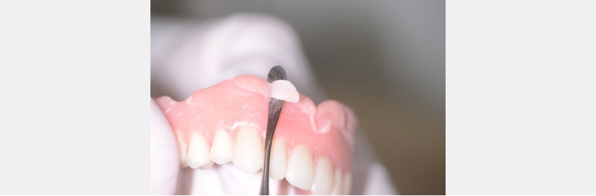 MaryAnneSalcetti PrimerSoftDentureLiners Fig.5