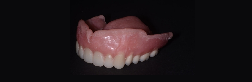 MaryAnneSalcetti PrimerSoftDentureLiners Fig.7