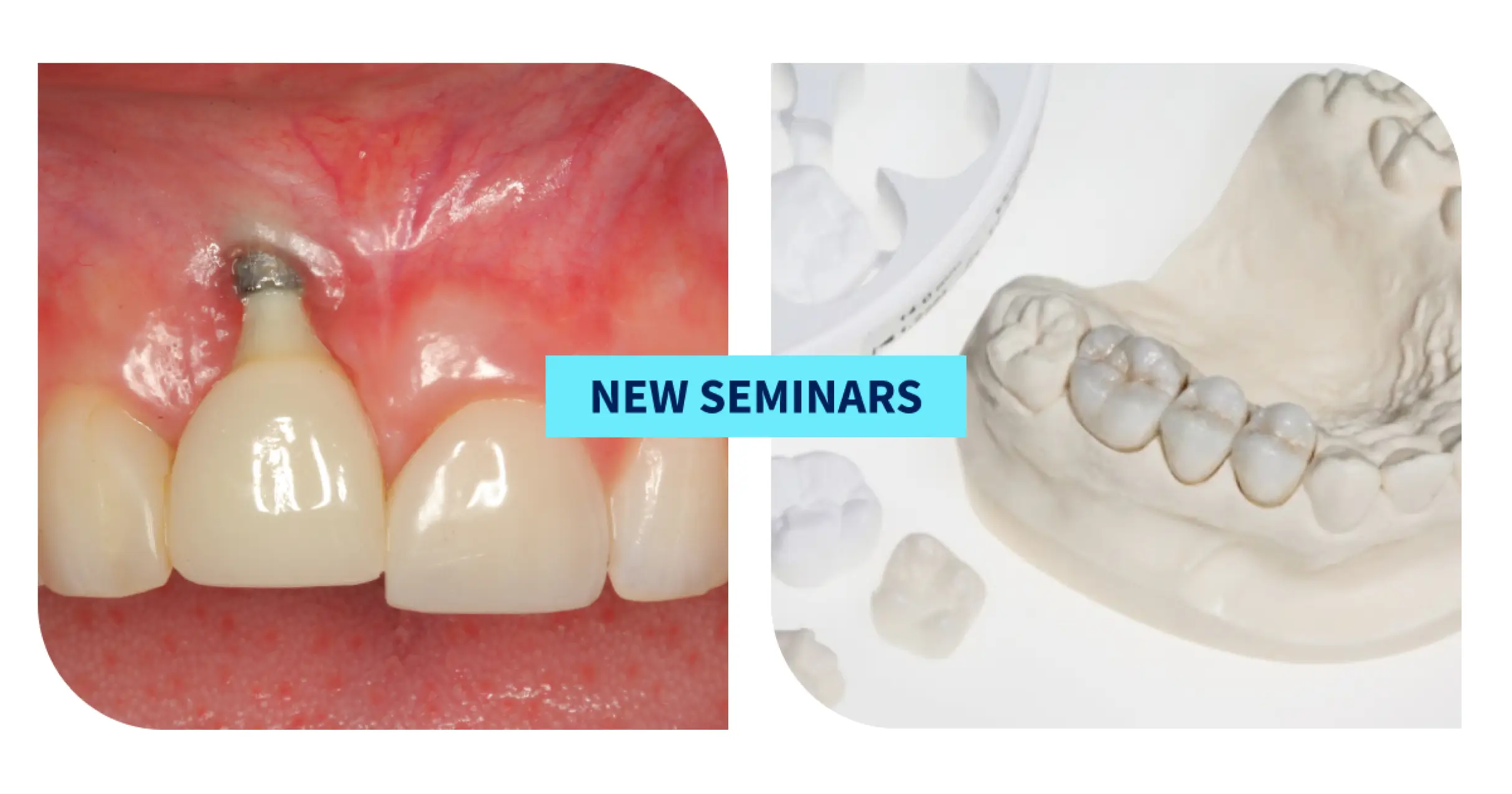 New Spear Seminars Empower Dentists To Master Real-World Challenges in Restorative Dentistry New Spear Seminars Empower Dentists