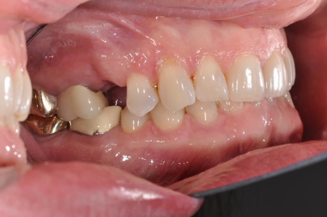 Ideal Position of the Central Incisor Rebecca Bockow Ideal Position of the Central Incisor fig 5