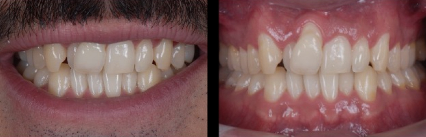 Ricardo Mitrani Battling the Dental Overtreatment Figure 1