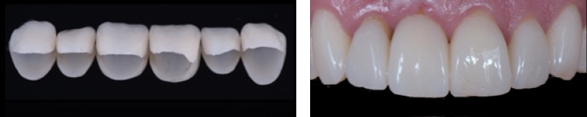 Ricardo Mitrani Battling the Dental Overtreatment Figure 11