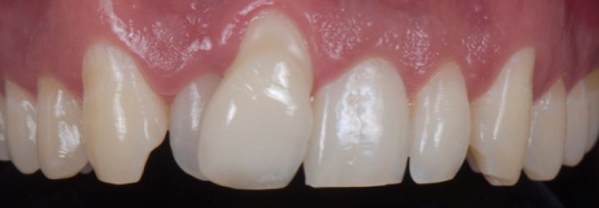 Ricardo Mitrani Battling the Dental Overtreatment Figure 2