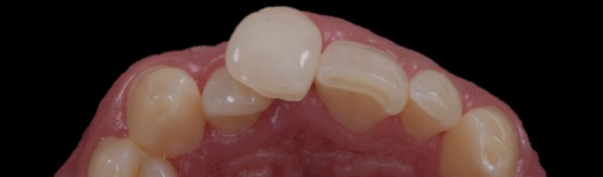 Ricardo Mitrani Battling the Dental Overtreatment Figure 3