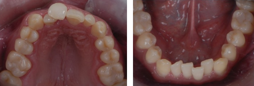 Ricardo Mitrani Battling the Dental Overtreatment Figure 4