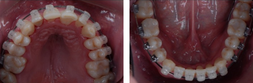 Ricardo Mitrani Battling the Dental Overtreatment Figure 5