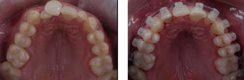 Ricardo Mitrani Battling the Dental Overtreatment Figure 6