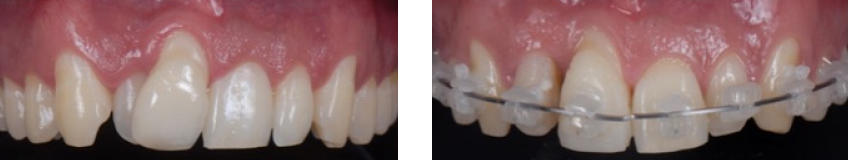Ricardo Mitrani Battling the Dental Overtreatment Figure 7