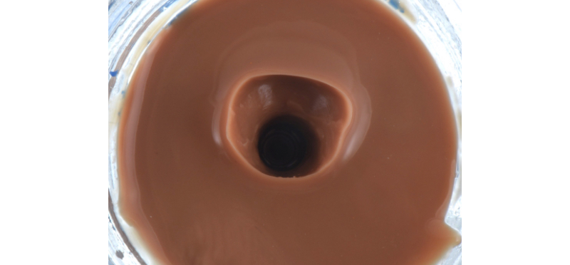 Customized Impression Coping for a Single Tooth Implant in a Maxillary Central Incisor RicardoMitrani CustImpressCopingSingleTooth Fig.7