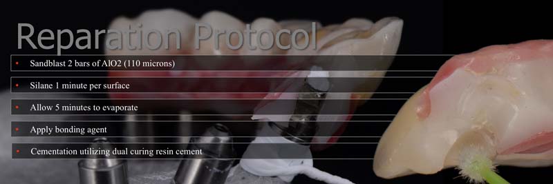 How to Temporarily Repair a Fractured Implant-Supported Zirconia Prosthesis RicardoMitrani TempRepairFracturedImplantZirconia Fig.7