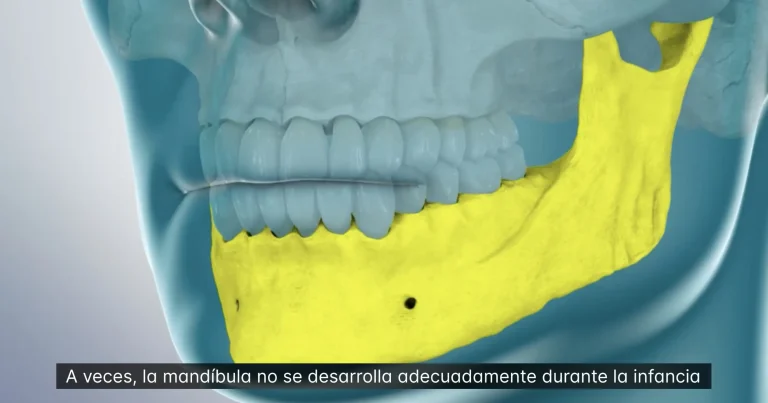 Spear Education Enhances Patient Education Videos with Spanish Subtitles