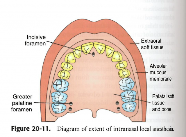 Andrew Cohen Should Dentists Use Kovanaze Nasal Spray Figure 3