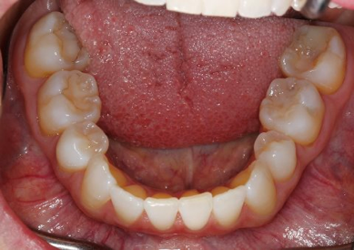 How Can a Patient's Overall Health Offer Clues To Potential Airway Issues? AndrewCohen how can a patients overall health offer clues to potential airway issues Fig.10