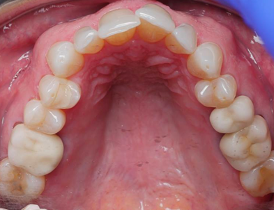 How Can a Patient's Overall Health Offer Clues To Potential Airway Issues? AndrewCohen how can a patients overall health offer clues to potential airway issues Fig.11