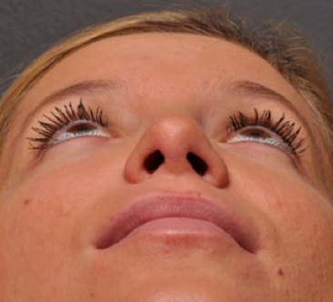 How Can a Patient's Overall Health Offer Clues To Potential Airway Issues? AndrewCohen how can a patients overall health offer clues to potential airway issues Fig.4