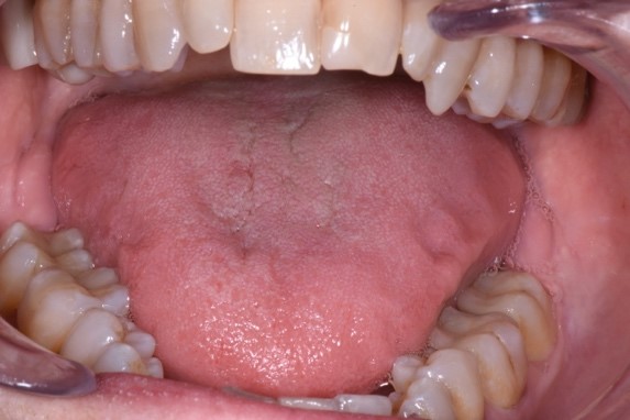 How Can a Patient's Overall Health Offer Clues To Potential Airway Issues? AndrewCohen how can a patients overall health offer clues to potential airway issues Fig.5