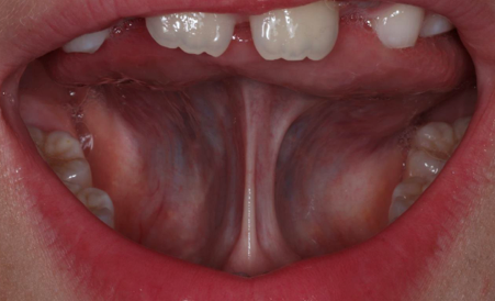 How Can a Patient's Overall Health Offer Clues To Potential Airway Issues? AndrewCohen how can a patients overall health offer clues to potential airway issues Fig.6