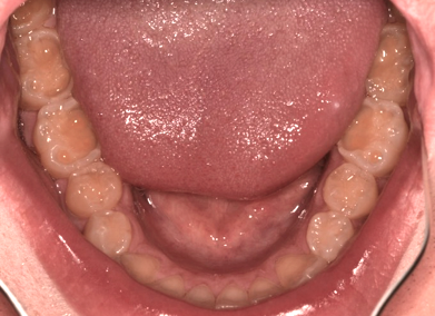How Can a Patient's Overall Health Offer Clues To Potential Airway Issues? AndrewCohen how can a patients overall health offer clues to potential airway issues Fig.7