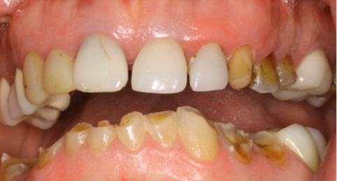 How Can a Patient's Overall Health Offer Clues To Potential Airway Issues? AndrewCohen how can a patients overall health offer clues to potential airway issues Fig.8