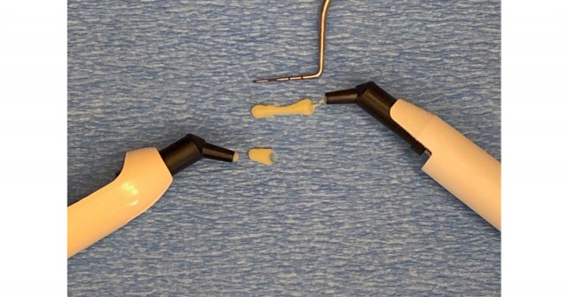 Heated Composite for Efficient Restorations