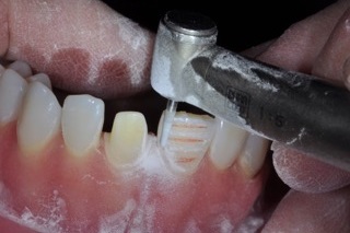 Restorative Design and the Sterile Pencil Bonk restorative design sterile pencil 02