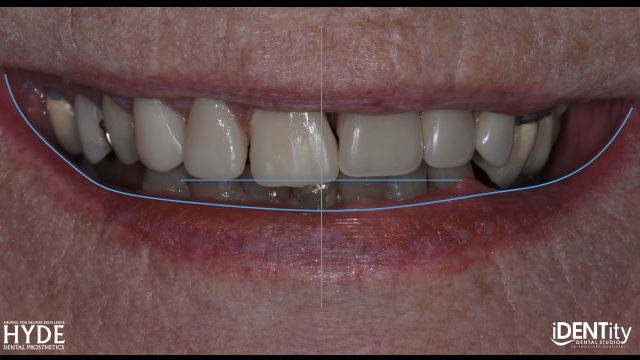 How To Ensure Successful Cross-Country 'ColLABoration' BrandonStapelton how to ensure successful cross country collaboration Fig.15