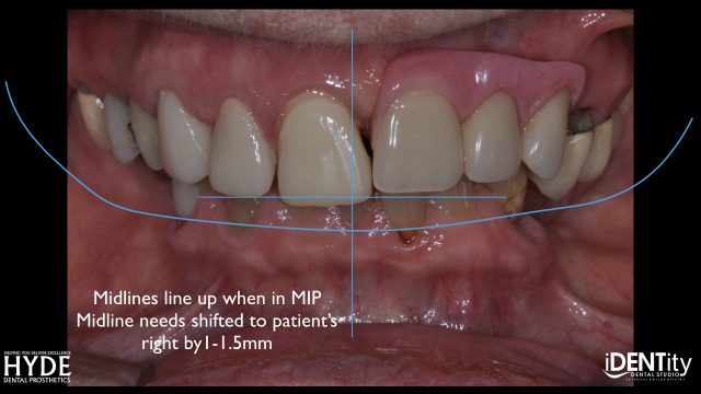 How To Ensure Successful Cross-Country 'ColLABoration' BrandonStapelton how to ensure successful cross country collaboration Fig.17