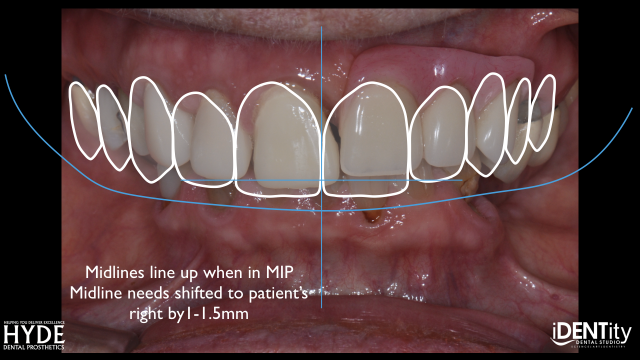 How To Ensure Successful Cross-Country 'ColLABoration' BrandonStapelton how to ensure successful cross country collaboration Fig.18