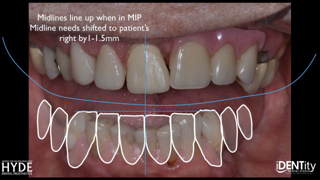 How To Ensure Successful Cross-Country 'ColLABoration' BrandonStapelton how to ensure successful cross country collaboration Fig.19