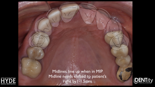 How To Ensure Successful Cross-Country 'ColLABoration' BrandonStapelton how to ensure successful cross country collaboration Fig.20
