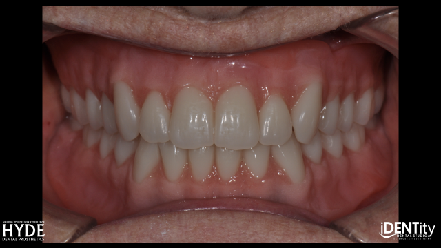 How To Ensure Successful Cross-Country 'ColLABoration' BrandonStapelton how to ensure successful cross country collaboration Fig.25