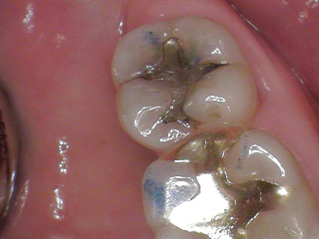 BrentBush how to see the new patients in your practice Fig.2