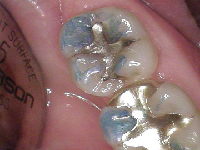 BrentBush how to see the new patients in your practice Fig.3