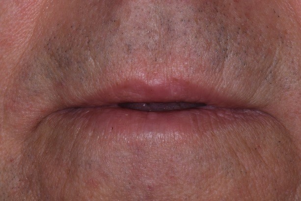 Where Is the Edge? CarlSteinberg WherIsTheEdge Fig.3