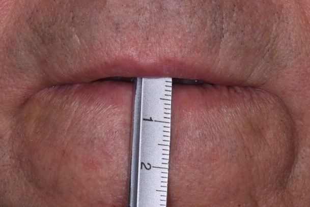 Where Is the Edge? CarlSteinberg WherIsTheEdge Fig.4