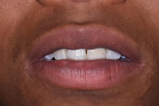 Where Is the Edge? CarlSteinberg WherIsTheEdge Fig.5