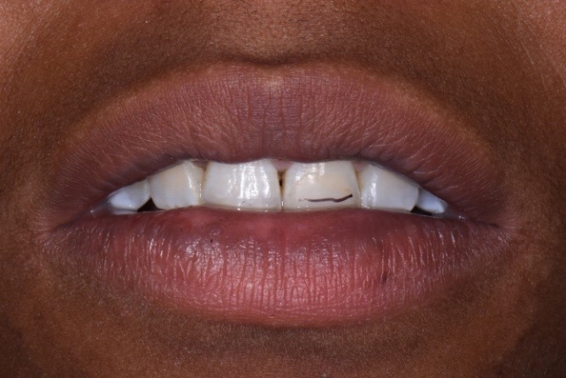 Where Is the Edge? CarlSteinberg WherIsTheEdge Fig.6