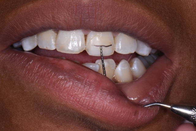 Where Is the Edge? CarlSteinberg WherIsTheEdge Fig.7