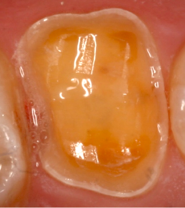 Need Smoother Preps? Carson Smooth Preps Featured Image