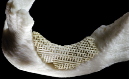 New Invention May Help the Body Generate New Bone Cody Lopez New Invention May Help The Body Generate New Bone Featured Image